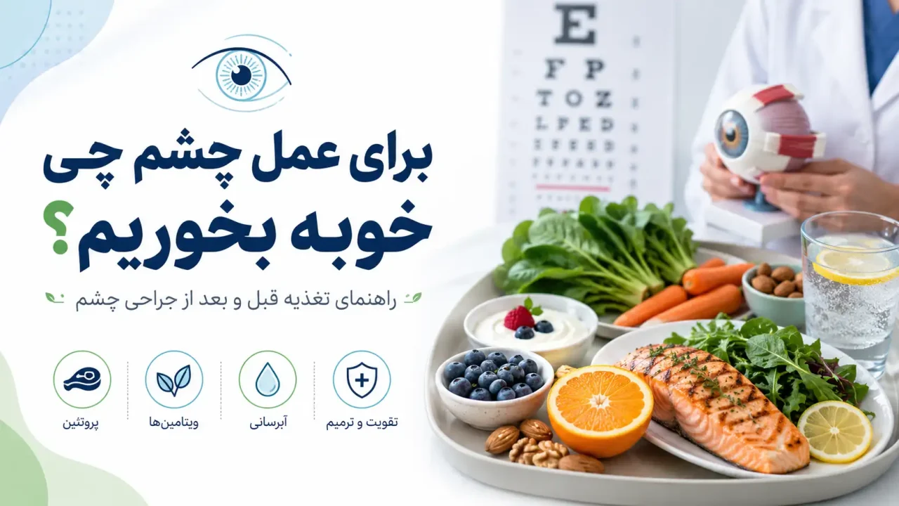 برای عمل چشم چی خوبه بخوریم