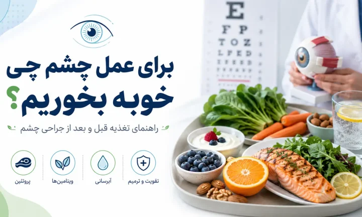 برای عمل چشم چی خوبه بخوریم