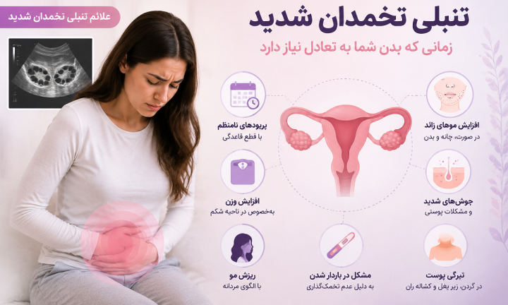 علائم تنبلی تخمدان شدید