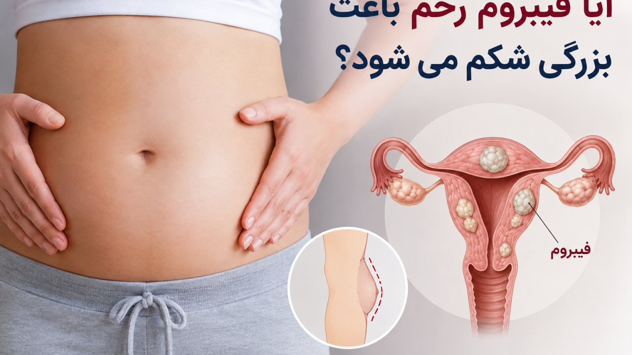 آیا فیبروم رحم باعث بزرگی شکم می‌شود
