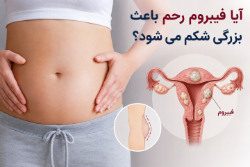 آیا فیبروم رحم باعث بزرگی شکم می‌شود
