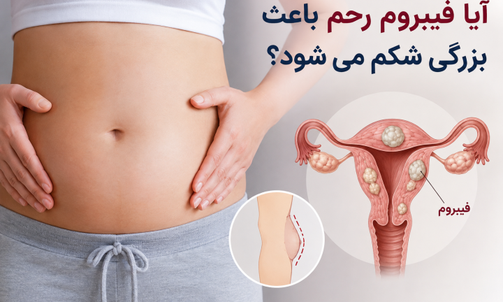 آیا فیبروم رحم باعث بزرگی شکم می‌شود