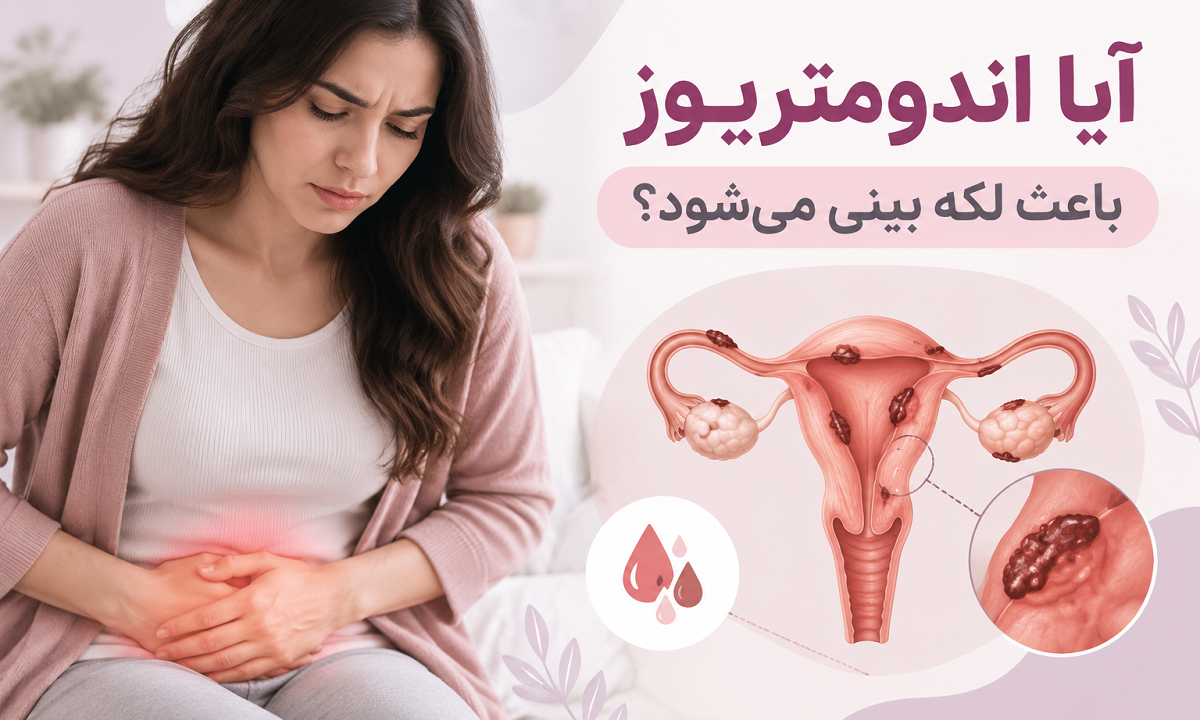 آیا اندومتریوز باعث لکه بینی می‌شود