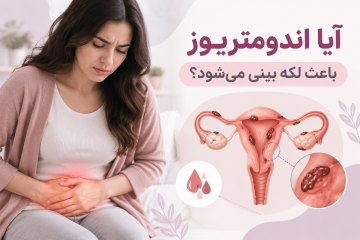 آیا اندومتریوز باعث لکه بینی می‌شود